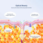 AcneClear™ LED Light Therapy Mask