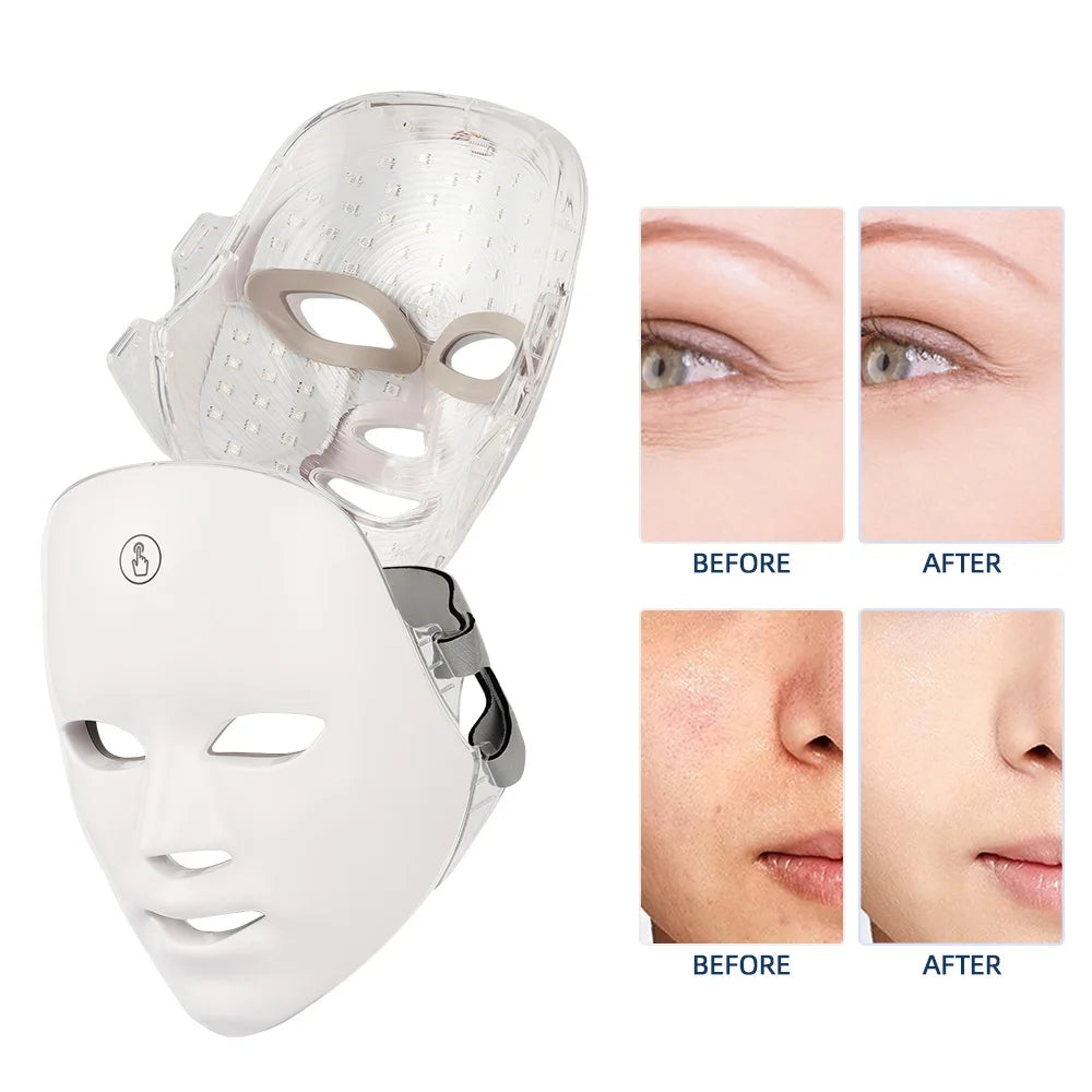 AcneClear™ LED Light Therapy Mask